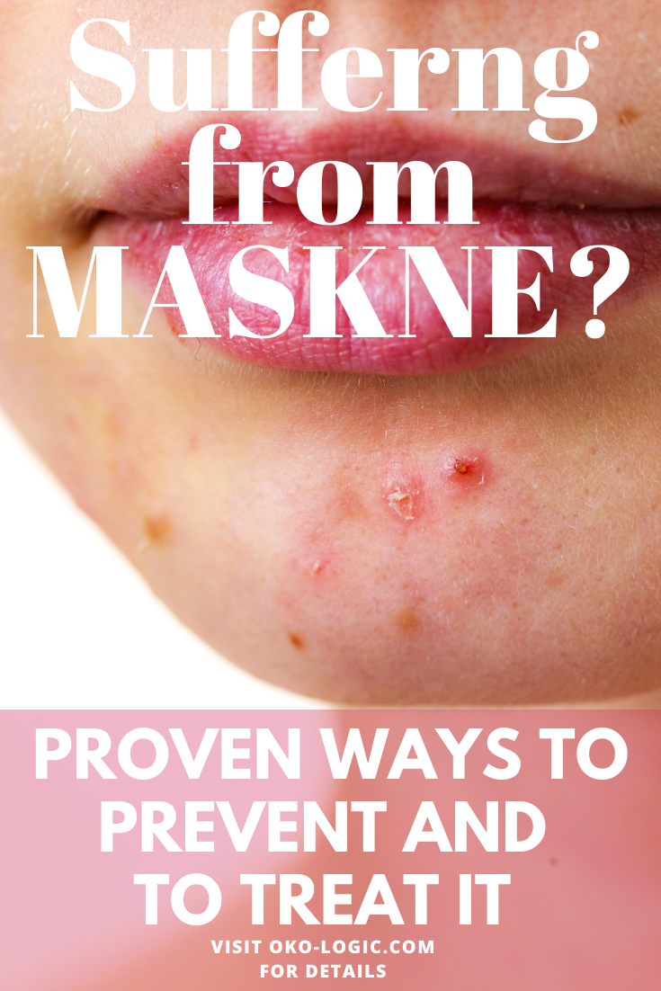11 Proven Mascne Treatment Options and Ways to Prevent It In the First Place